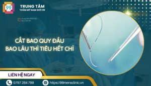 Cắt bao quy đầu bao lâu thì tiêu hết chỉ