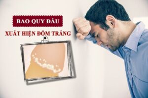 cậu nhỏ có đốm trắng
