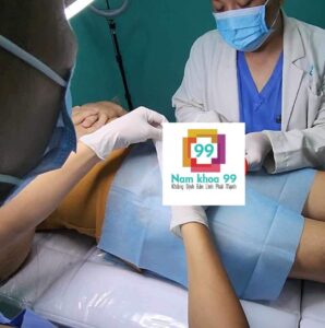 phẫu thuật trị xuất tinh sớm