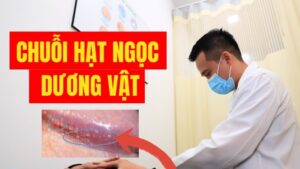chuỗi hạt ngọc dương vật có lây không