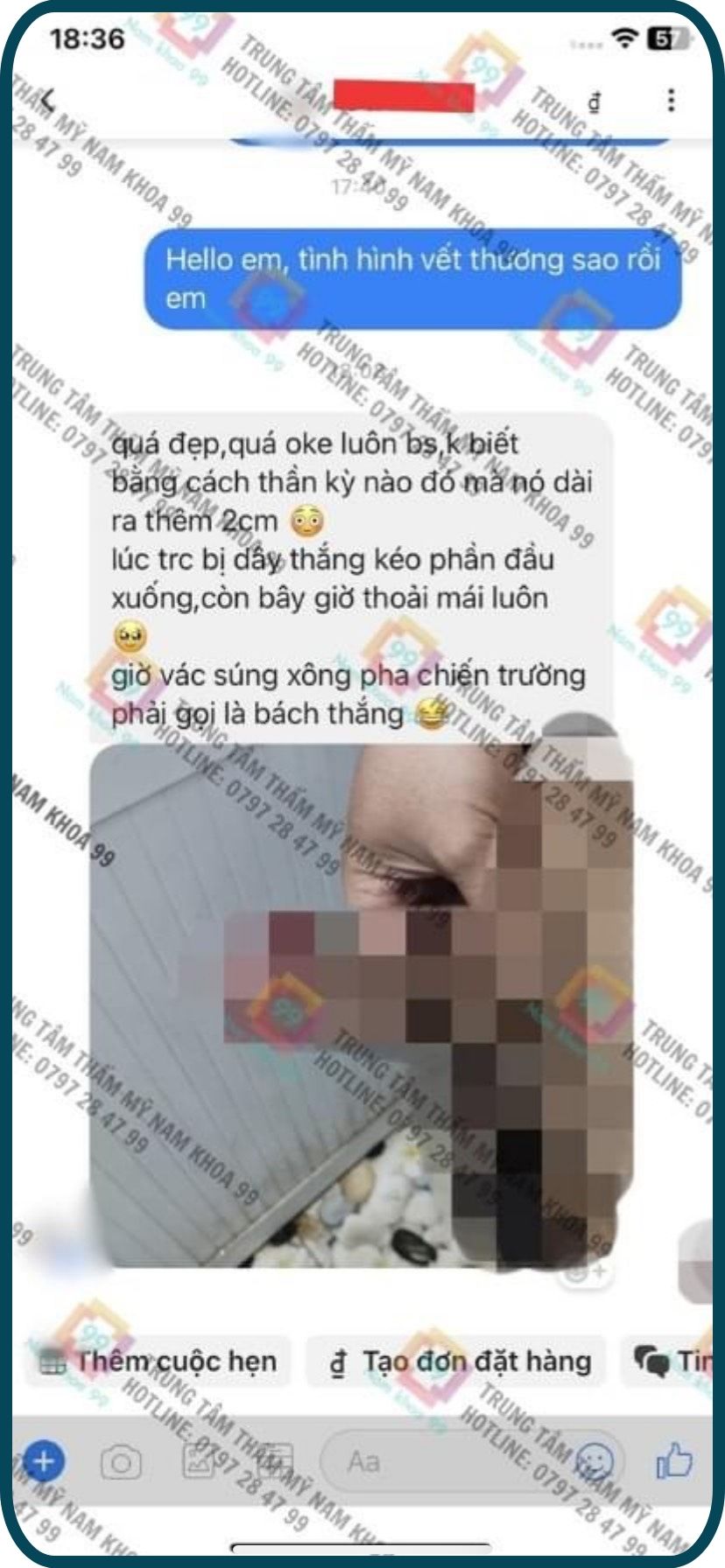 Khách hàng ưng ý sau khi làm to